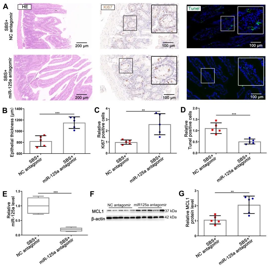 【更新】动物用antagomir产品案例应用策略解析(20211026)丨含给药方式、给药剂量、动物造模、实验处理……