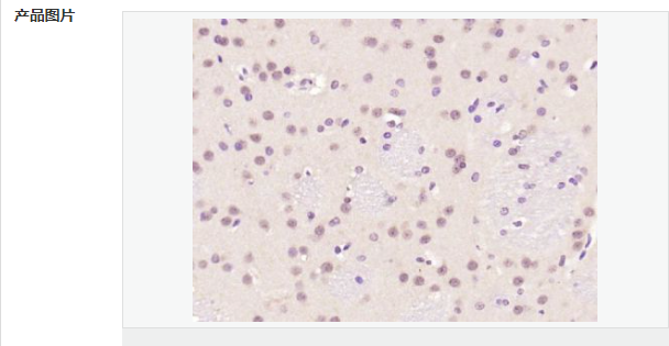 磷酸化c-fos抗体