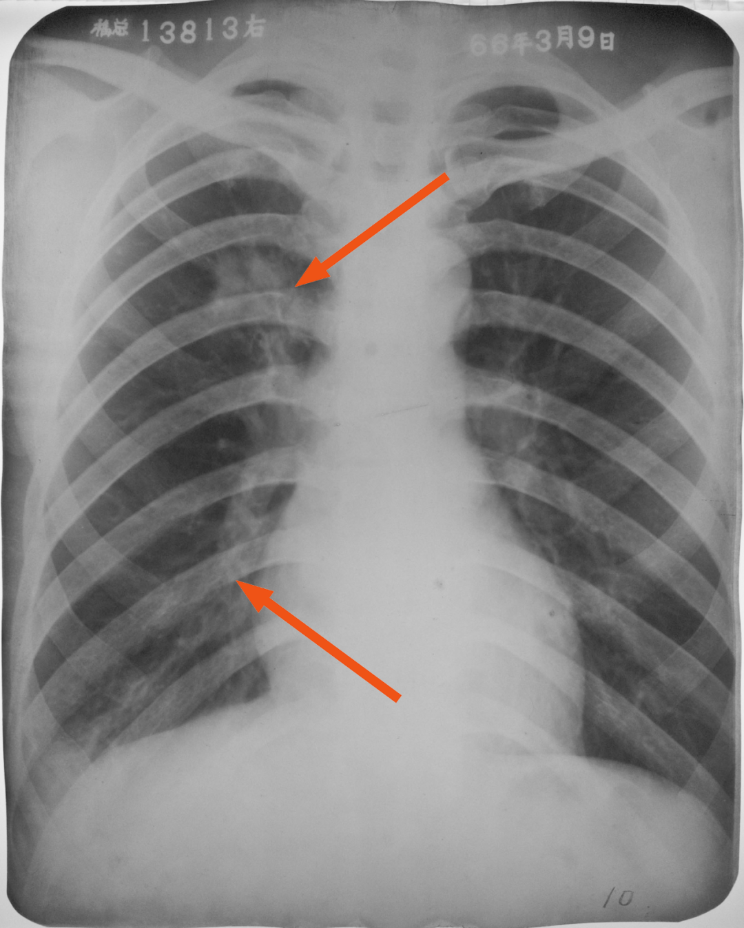 在病房医院，医生拿着胸片或x光片检查照片摄影图片_ID:301057189-Veer图库