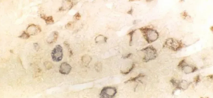 分享一抗选择要点及二抗的原理特点