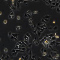 人肺癌细胞 A-549