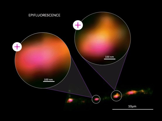 揭秘Nanoimager超分辨率成像背后的利器