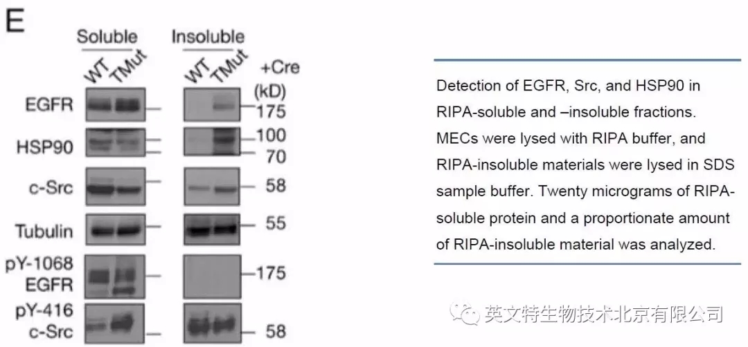 磷酸化蛋白 WB 有点难？第一步可能就做错了！