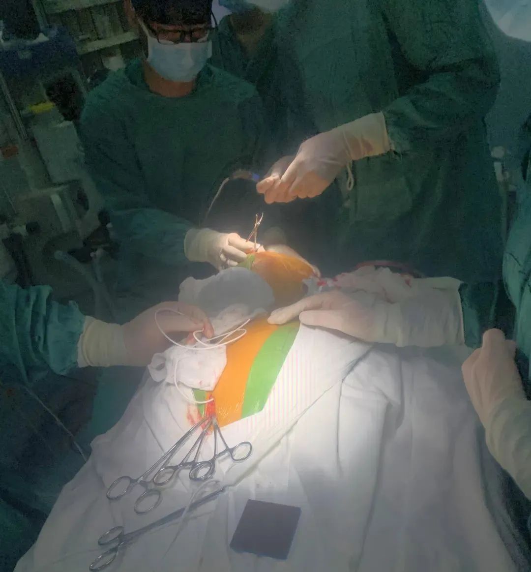 男子高空作业不慎摔下导致颅脑重伤合并多发伤，多学科全力救治最终化险为夷