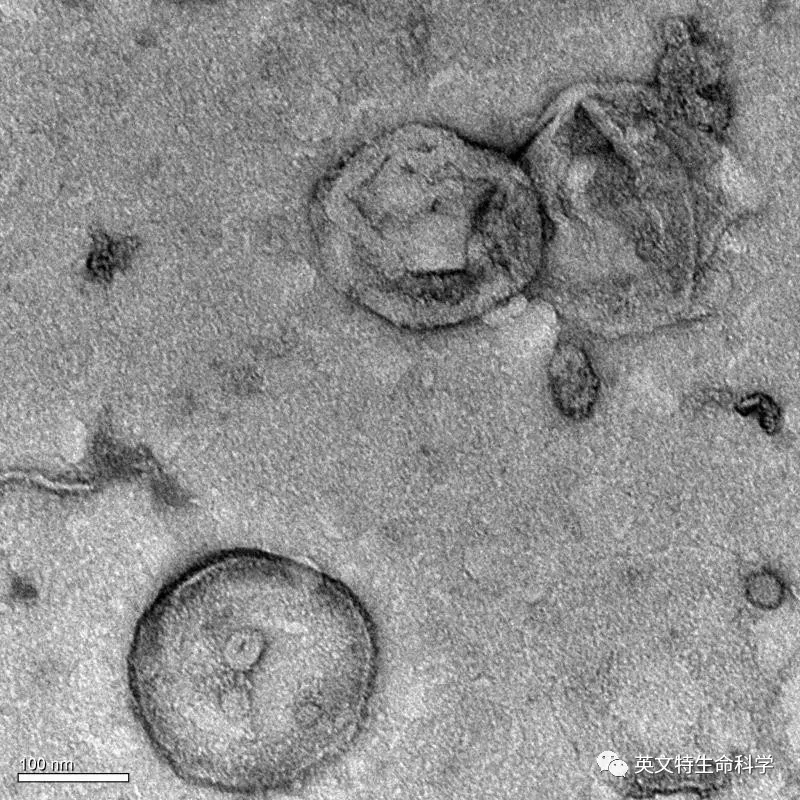 Invent 柱式法蛋白提取技术到底好不好用?看看小伙伴怎么说!