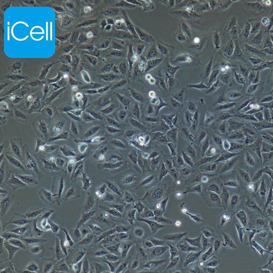 HCC1428 人乳腺导管癌细胞/STR鉴定/镜像绮点（Cellverse）