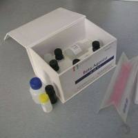 PBS缓冲液（10X）