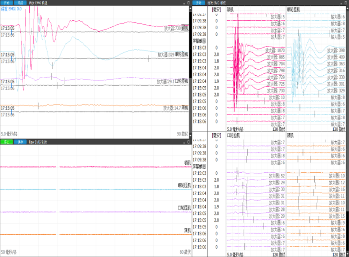 腮腺「鼓包」别害怕 术中「神探」来护驾