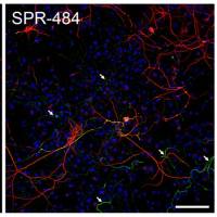 Alpha Synuclein 寡聚体(动态学稳定的)