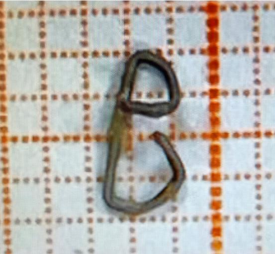 肺癌手术 9 年后再胸痛  原来是一颗「脱岗」的钉子在捣乱  避免这样的后患 术后静养少不得        