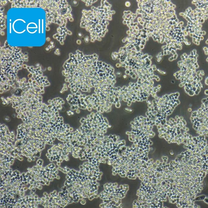 COLO320人结直肠腺癌细胞/STR鉴定/镜像绮点（Cellverse）