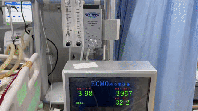 国产 ECMO 研发新突破，在西安交大一附院率先临床应用