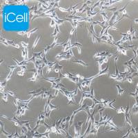 MDS-L、MDS-L细胞、MDSL细胞、MDSL、 人骨髓增生异常综合征细胞/STR鉴定/镜像绮点（Cellverse）