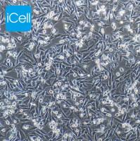 A375|A375细胞|A-375|A-375细胞|A375人皮肤黑色素瘤细胞/STR鉴定/镜像绮点(Cellverse)