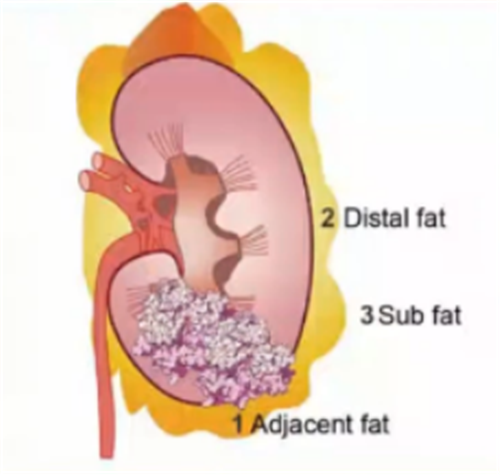 专家讲坛 | 威斯腾生物联合中国抗癌协会肿瘤代谢专委会网络学术沙龙系列讲座第五十一讲