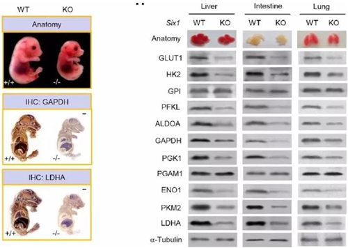 专家讲坛 | 威斯腾生物联合中国抗癌协会肿瘤代谢专委会网络学术沙龙系列讲座第四十九讲