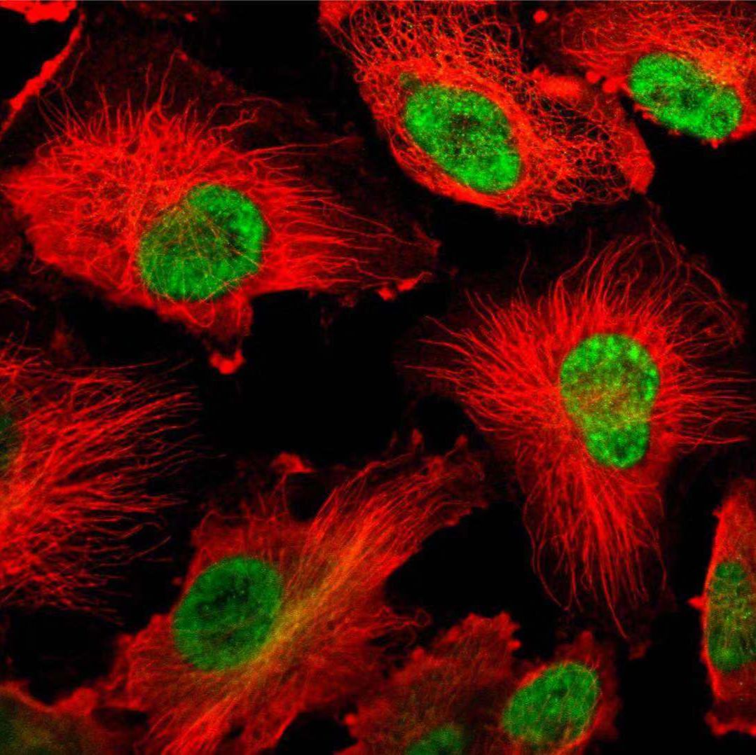 小鼠主动脉内皮细胞/免疫荧光鉴定/镜像绮点（Cellverse）