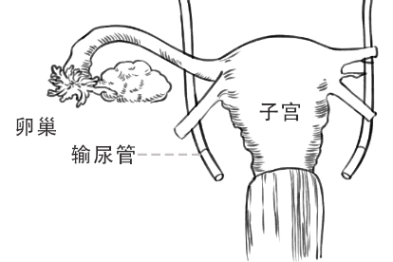 一有性生活，这个癌就盯上你！都长点心吧～