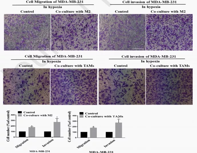 五分钟文献解读之《galectin-3参与TAM促肿瘤的机制》