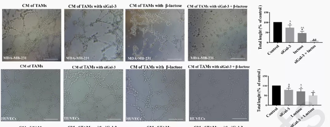 五分钟文献解读之《galectin-3参与TAM促肿瘤的机制》