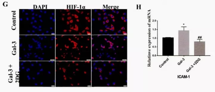 五分钟文献解读之《galectin-3参与TAM促肿瘤的机制》