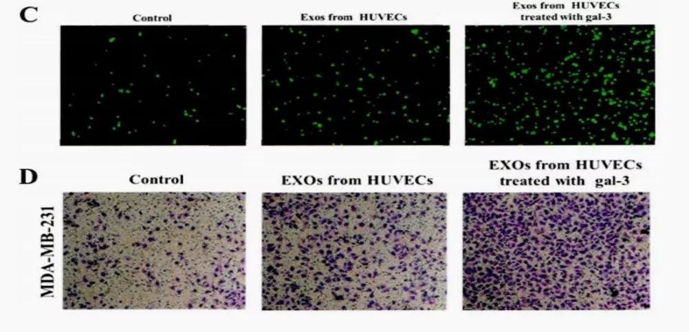 五分钟文献解读之《galectin-3参与TAM促肿瘤的机制》