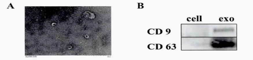 五分钟文献解读之《galectin-3参与TAM促肿瘤的机制》