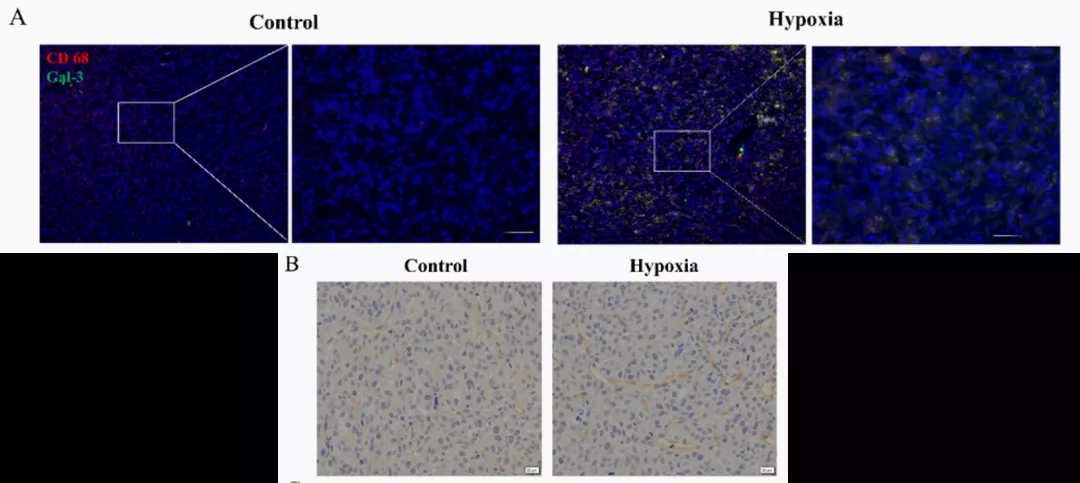 五分钟文献解读之《galectin-3参与TAM促肿瘤的机制》