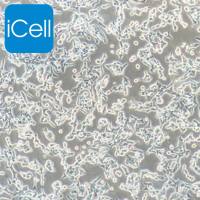 VCaP、VCaP细胞、VCaP细胞、人前列腺癌细胞/STR鉴定/镜像绮点（Cellverse）