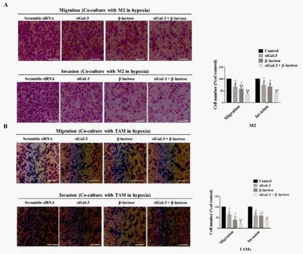 五分钟文献解读之《galectin-3参与TAM促肿瘤的机制》