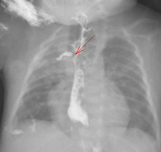 数字化摄影是什么检查「协和_https://www.jmylbn.com_新闻资讯_第31张