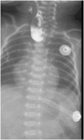 数字化摄影是什么检查「协和_https://www.jmylbn.com_新闻资讯_第28张