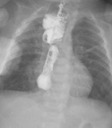 数字化摄影是什么检查「协和_https://www.jmylbn.com_新闻资讯_第33张