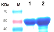 人白细胞介素1β (IL-1β)-V1重组蛋白