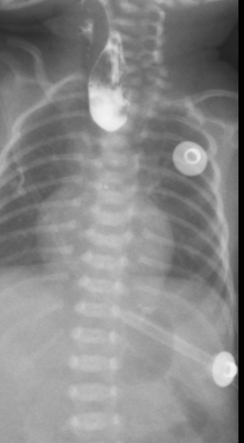 数字化摄影是什么检查「协和_https://www.jmylbn.com_新闻资讯_第27张