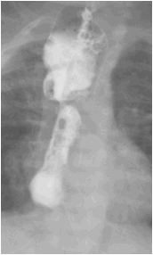 数字化摄影是什么检查「协和_https://www.jmylbn.com_新闻资讯_第34张