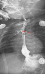 数字化摄影是什么检查「协和_https://www.jmylbn.com_新闻资讯_第30张