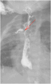 数字化摄影是什么检查「协和_https://www.jmylbn.com_新闻资讯_第32张