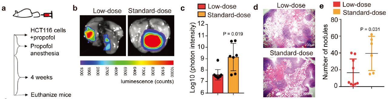 文献速递ㅣ常用静脉麻醉药丙泊酚或致肿瘤侵袭/转移增加