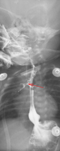 数字化摄影是什么检查「协和_https://www.jmylbn.com_新闻资讯_第29张