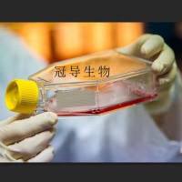 MN20 Cell;MN20细胞系(STR鉴定图谱)