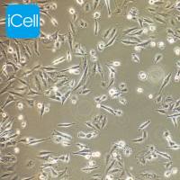 OPM2细胞 | OPM-2细胞 | OPM-2 | OPM-2 | 人多发性骨髓瘤细胞/STR