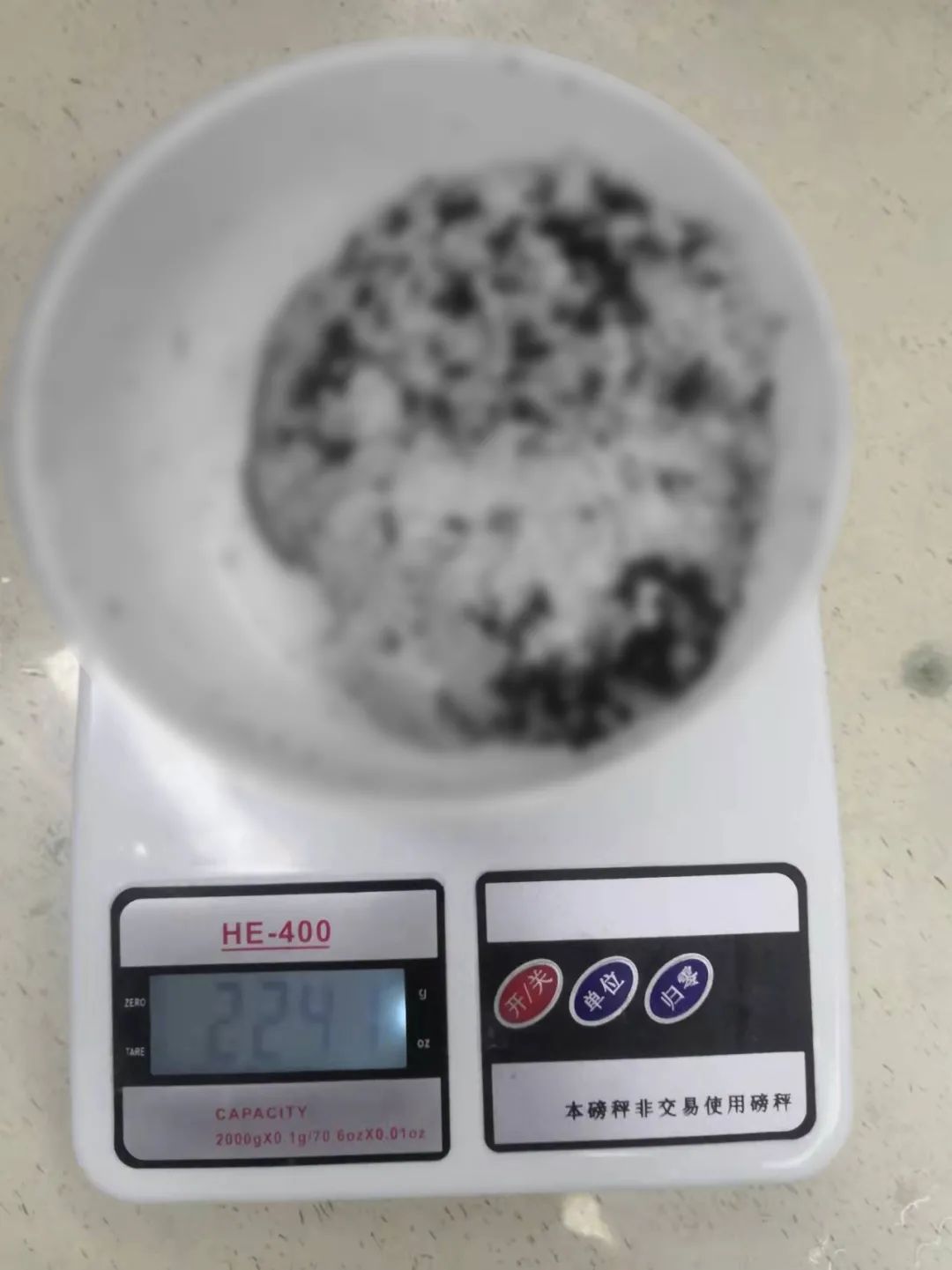 西安高新医院泌尿外科使用钬激光完成巨大前列腺剜除