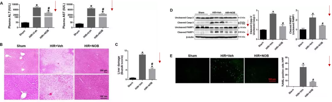 五分钟文献解读之《Nobiletin通过激活SIRT-1/FOXO3a介导的自噬和线粒体生物发生改善肝缺血再灌注损伤》