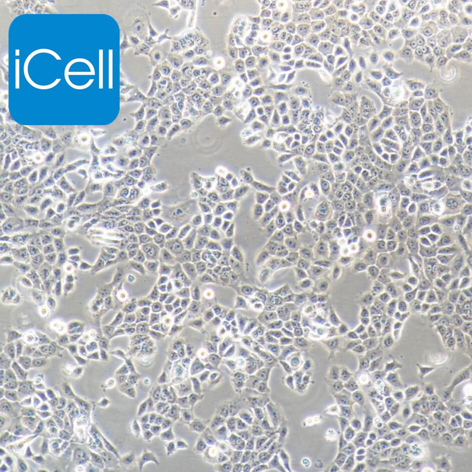 CAL-27 人舌鳞癌细胞/STR鉴定/镜像绮点（Cellverse）