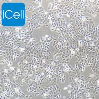 CAL-27 人舌鳞癌细胞/STR鉴定/镜像绮点(Cellverse)