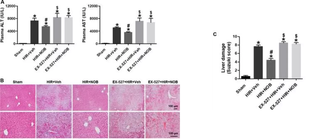 五分钟文献解读之《Nobiletin通过激活SIRT-1/FOXO3a介导的自噬和线粒体生物发生改善肝缺血再灌注损伤》