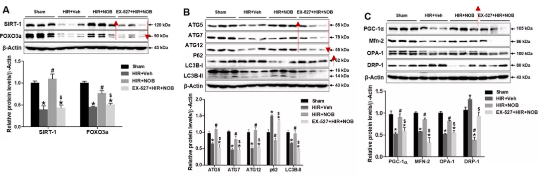 五分钟文献解读之《Nobiletin通过激活SIRT-1/FOXO3a介导的自噬和线粒体生物发生改善肝缺血再灌注损伤》
