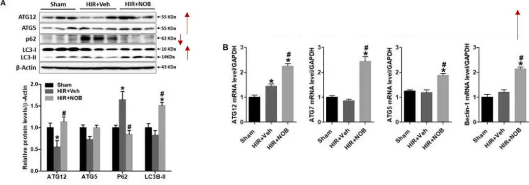 五分钟文献解读之《Nobiletin通过激活SIRT-1/FOXO3a介导的自噬和线粒体生物发生改善肝缺血再灌注损伤》