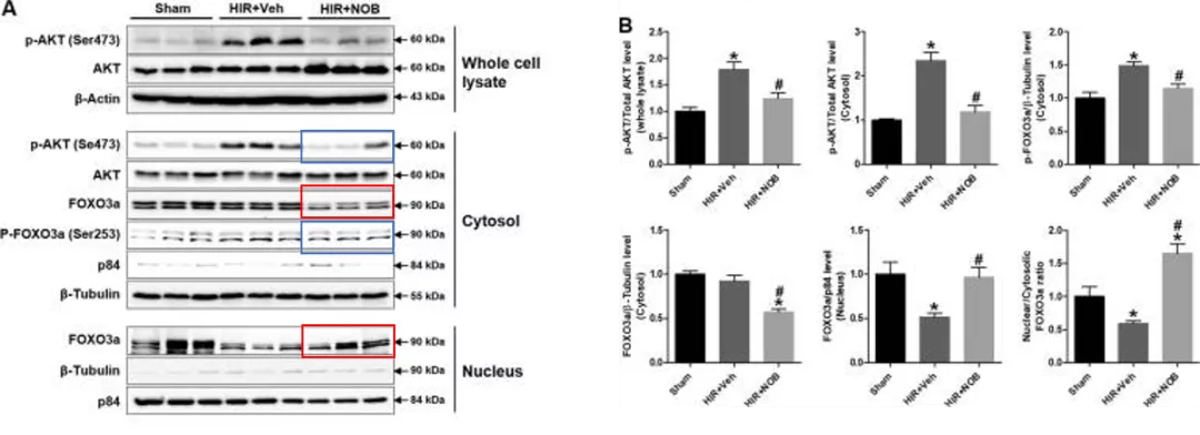 五分钟文献解读之《Nobiletin通过激活SIRT-1/FOXO3a介导的自噬和线粒体生物发生改善肝缺血再灌注损伤》